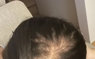 Pomôžte Márii pri boji s rakovinou krčka maternice