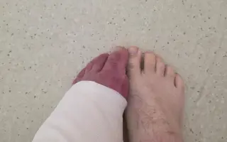 Pomôžme otcovi rodiny, ktorý bojuje s agresívnym sarkómom