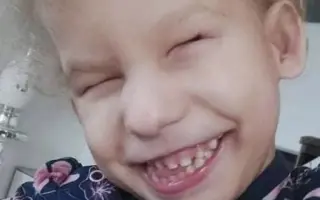 Osemročné kučeravé dievčatko Miška potrebuje našu pomoc