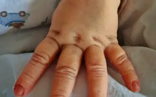 Pomôžte Adamkovi napredovať vďaka rehabilitáciám