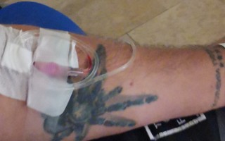 Pomôžme Marekovi získať auto, ktoré ho dovezie k potrebnej zdravotnej starostlivosti