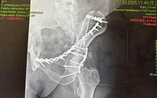 Pomôžme Petrovi s prežitím obdobia medzi PN a invalidným