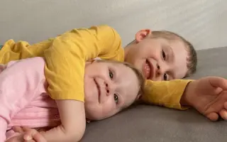 Malá Timejka potrebuje ďalej rehabilitovať - pomôžme jej
