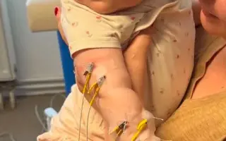 Pre Sofinku: Pomôžte 7-mesačnej bojovníčke rozhýbať ochrnutú rúčku