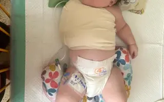 Pre Sofinku: Pomôžte 7-mesačnej bojovníčke rozhýbať ochrnutú rúčku