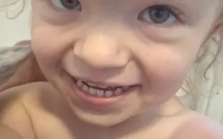 Pomôžme Jakubkovi rásť napriek achondroplázii