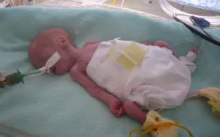 Pomôžme 14-ročnému Alexovi a jeho mame zvládnuť nákladné rehabilitácie