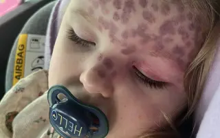 Pomôžme Jasmínke rozkvitnúť