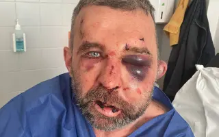 Pomohli ste Tomášovi po brutálnom napadnutí