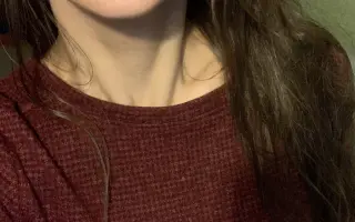 Pomôžme Dominike zbaviť sa bolesti zubov a začať odznova