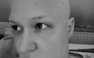 Pomôžme Zuzke získať šancu na život