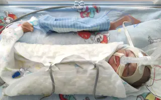 Martinko bojuje s DMO a epilepsiou. Zabezpečme mu potrebné rehabilitácie.