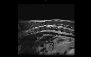 Darujme Šeďovi šancu na návrat k normálnemu životu