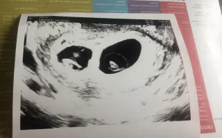 Pomôžme rýchlo sa rozrastajúcej rodine zabezpečiť auto