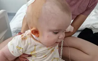 Pomôžme Julke spraviť prvý krok