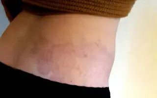 Liečba, ktorá pomôže aj na duši