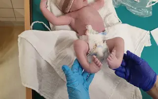 Pomôžme novorodencovi Leovi s liečbou clubfoot vo Viedni