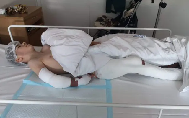 Pomôžme Kikovi pokračovať v náročnej liečbe zdeformovaných nožičiek