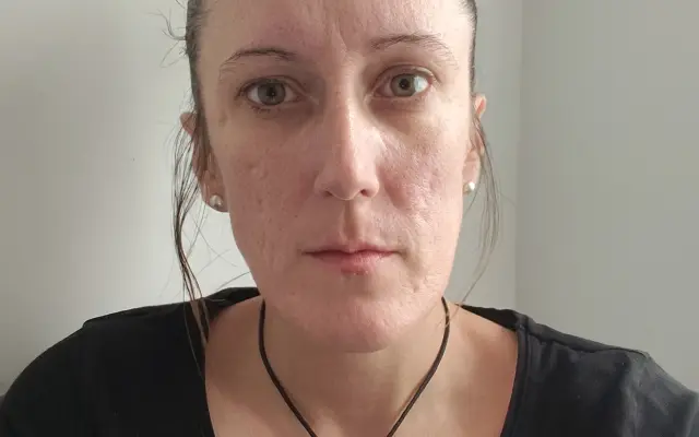 Pomoc pre mamu samoživiteľku na opatrovateľskom: Zachráňme Ivane zdravie zubov